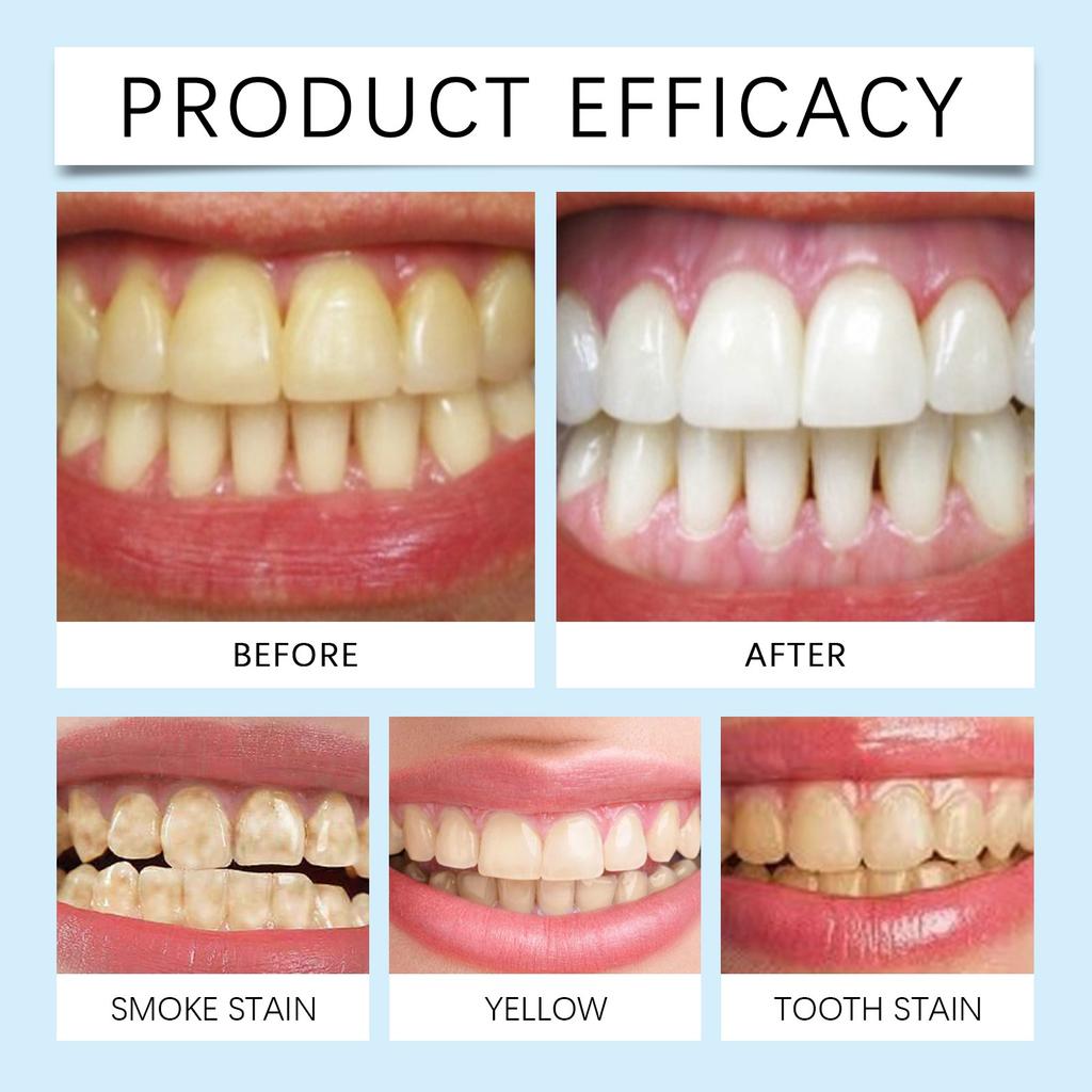 Зубной порошок для отбеливания и удаления пятен укрепляет зубную эмаль, отбеливает зубы, удаляет пятна и освежает дыхание