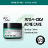 AHA BHA PHA 30 Days Miracle Cream 60gr AUTHENTIC STORE