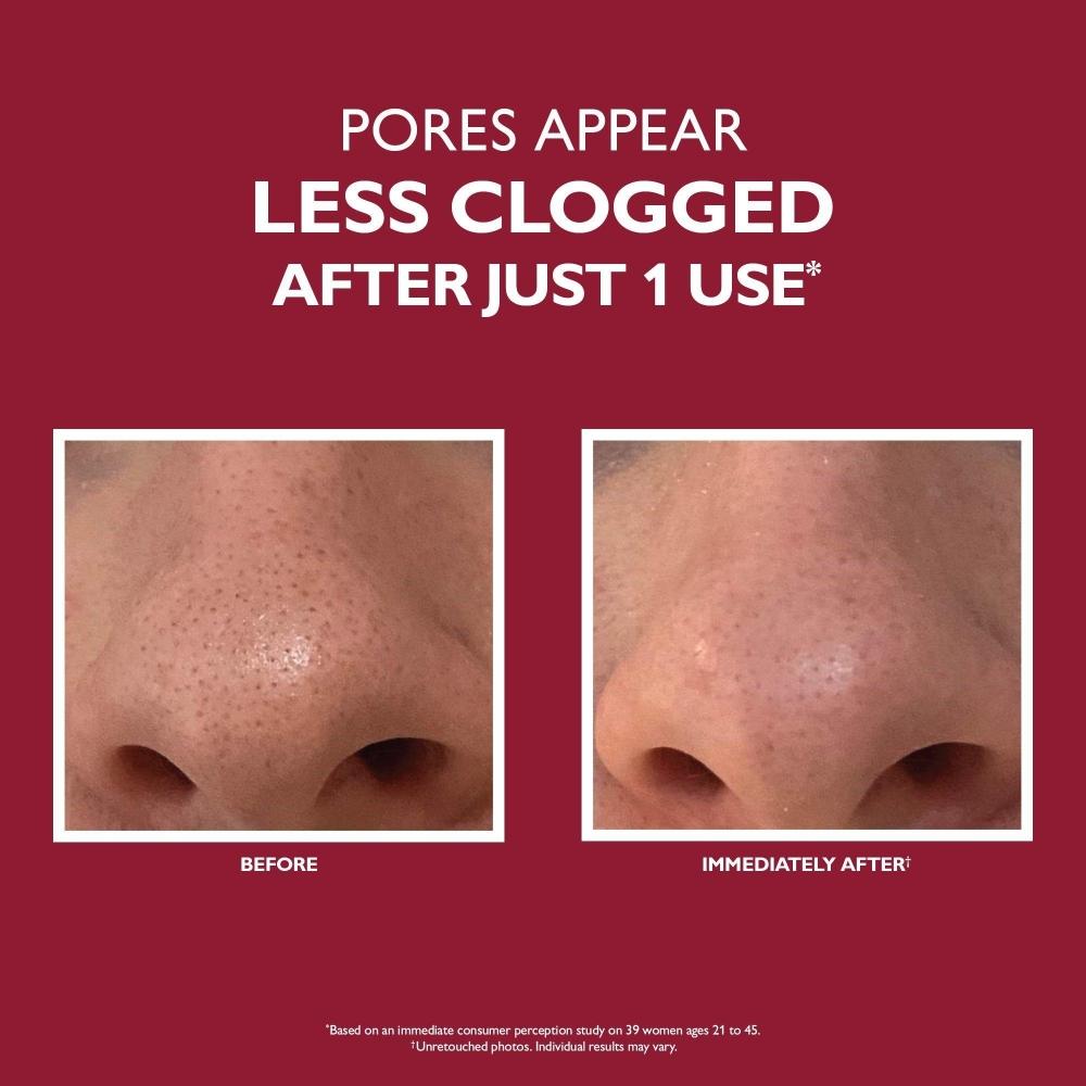 Peter Thomas Roth Еще более гладкая микродермабразия Отшелушивающее средство для пор