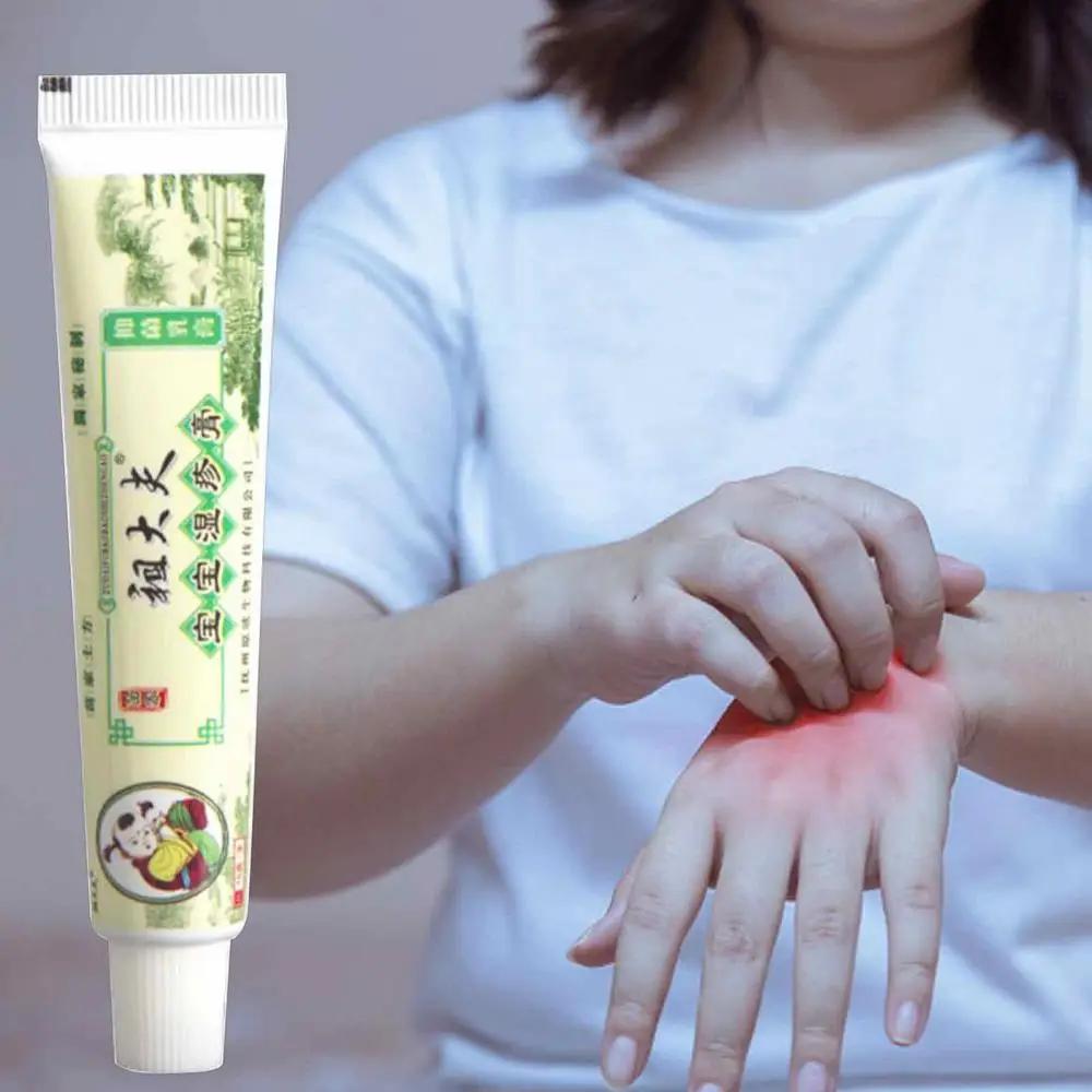 Мазь для ухода за кожей Zudaifu Травяной крем для детей Младенец Натуральный Не раздражающий