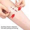 Emergency Wound Closure Zip Stitch Sutures Bandaids Repair Wounds Without Stitches For Outdoor Activities Quick Clot Wound