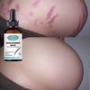 Repairing Stretch Marks During Pregnancy, Moisturizing and Nourishing