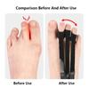 1 шт. корректор для пальцев ног ортопедические средства для ухода за ногами костный регулятор большого пальца молоток протектор корректор ортопедические инструменты для ухода