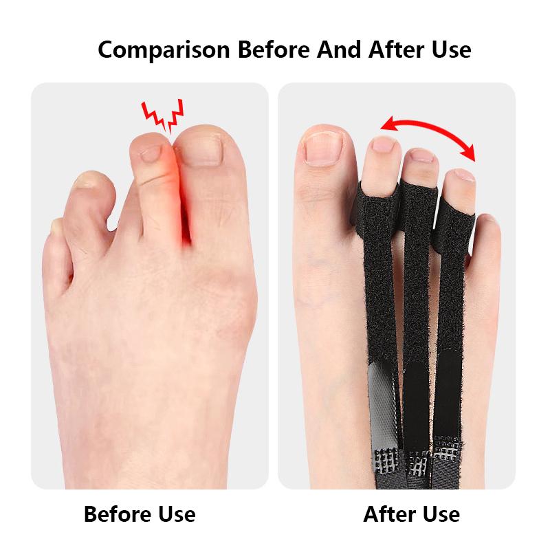 1 шт. корректор для пальцев ног ортопедические средства для ухода за ногами костный регулятор большого пальца молоток протектор корректор ортопедические инструменты для ухода