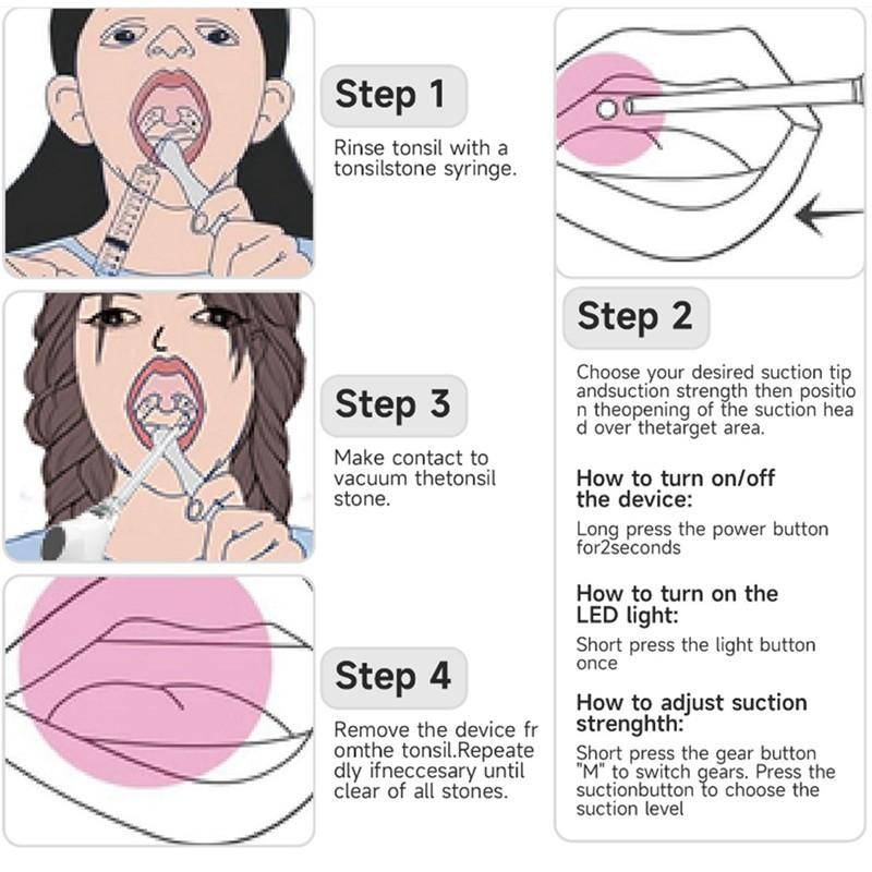 Электрический вакуумный удалитель миндалин, ручной набор для удаления миндалин, инструмент для чистки полости рта