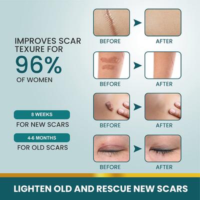 1 рулон силиконовых пластырей для рубцов, гелевый пластырь для рубцов 4 см x 150 см, самоклеящаяся лента для покрытия рубцов, многоразовые и эффективные полоски для ухода за кожей