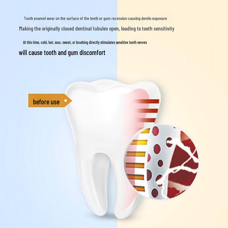Cold Acid Ling Anti-Sensitivity Pump Toothpaste