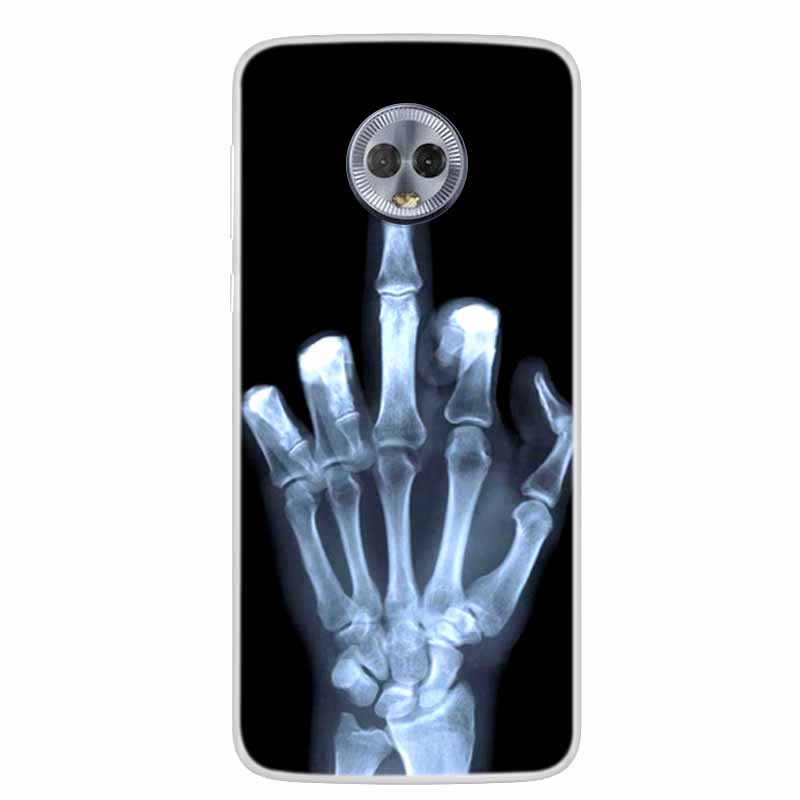 For Moto G6 Plus Case G6 Play Lovely Cat Soft TPU Silicone Transparent Phone Case For Motorola Moto G6 Cover Clear Bumper MotoG6