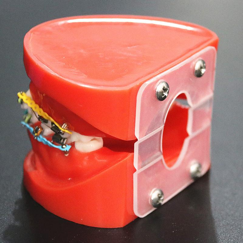 1 шт., прозрачная стоматологическая ортодонтическая модель прикуса с брекетами, буккальная трубка дуги для общения с пациентом