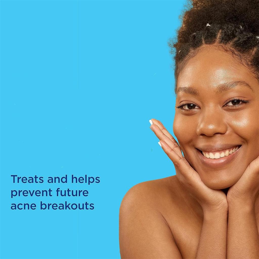 Acne Gel Acne Moisturizing Gel Is Suitable For Sensitive Skin And Gentle Skin Care45g