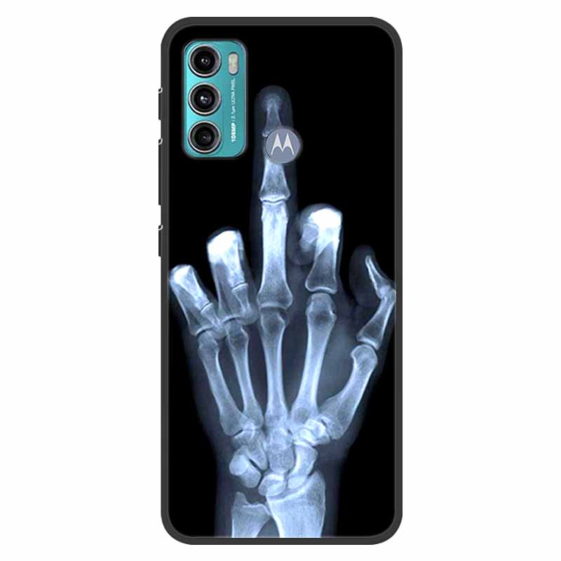 Чехол для Motoroal Moto G60, противоударный, из мягкого силикона TPU, задняя крышка для Moto G60S G 60, чехлы для телефона Motorola G60, милый мультяшный