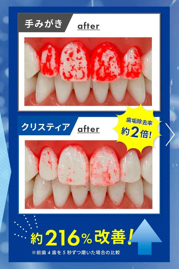 White Essence Christia электрическая зубная щетка Sonic вращающаяся перезаряжаемая отбеливающая щетка для зубов оригинальный продукт (Основной предмет)