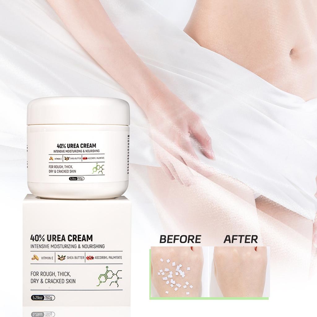 Urea Cream 40%, Hand & Foot Moisturizer For Dry Cracks Nourishes The Hands And Feet And The Skin Is Smooth And Soft,150g