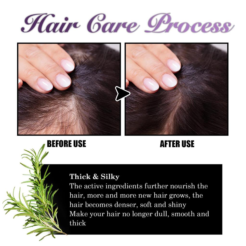 EELHOE Спрей для волос с луком и розмарином, глубоко увлажняющий кожу головы, разглаживающий и блестящий спрей-кондиционер для волос