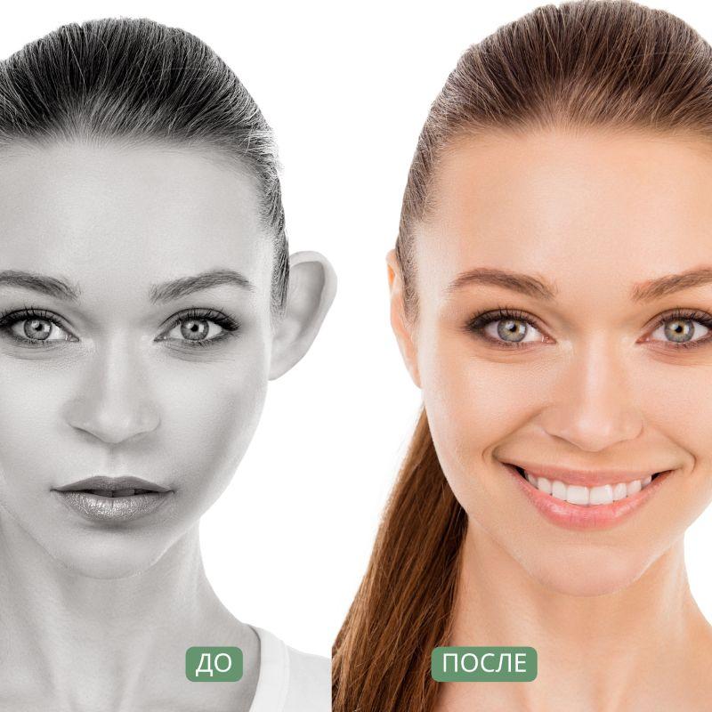 Earlap Max Hold Cosmetic Prominent Ear Corrector Tape, Prominent Ear Tape, Ear Tape