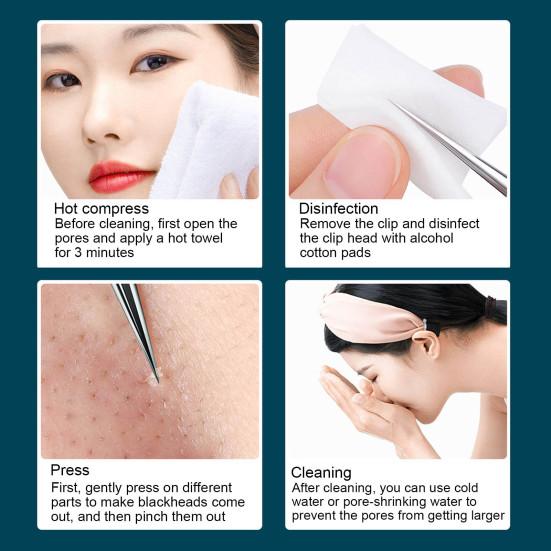 Очень тонкий Нет. 5 пинцетов из нержавеющей стали для удаления угрей и черных точек для ухода за кожей, экстрактор черных точек с 10-кратным увеличительным стеклом, щадящий инструмент для удаления угрей