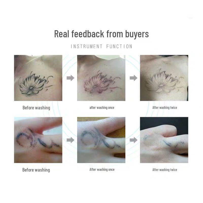 Портативная пикосекундная лазерная ручка для удаления татуировок, веснушек и бровей с красным и синим светом