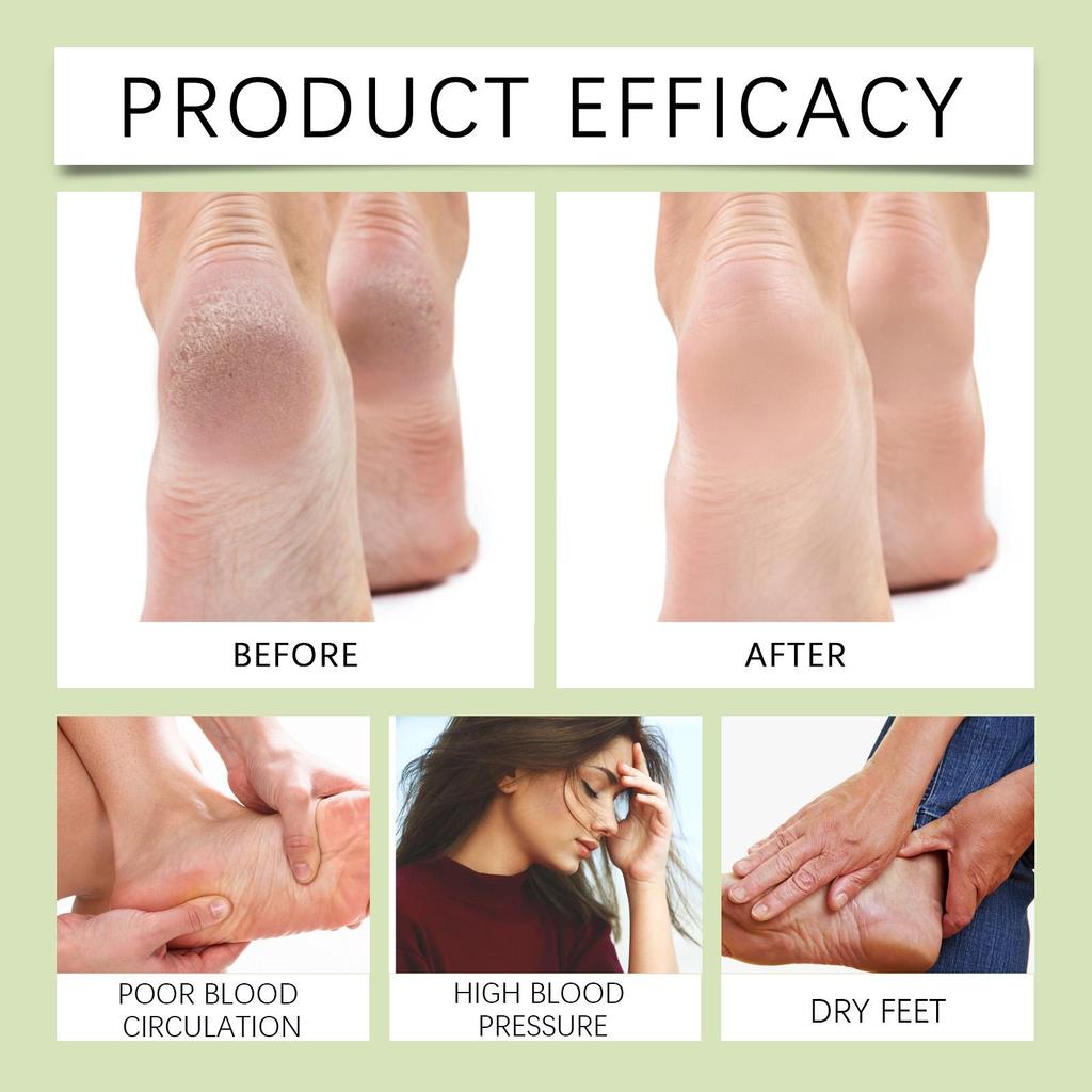 South Moon Ginger Foot Care Pack Herbal Ingredients Foot Soak Relieves Tight Feet Cleansing & Conditioning