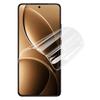 IMAK Гидрогелевая пленка 4-го поколения Защитная пленка для экрана для Xiaomi Redmi K80 5G/K80 Pro 5G/K80 Pro Champion Edition Сверхпрозрачная ТПУ пленка
