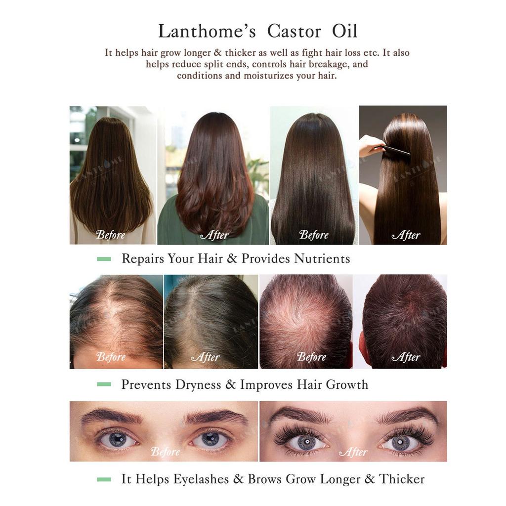 Castor Oil Natural Hair Growth Eyebrow Enhancer   Lift  Organic 10ml