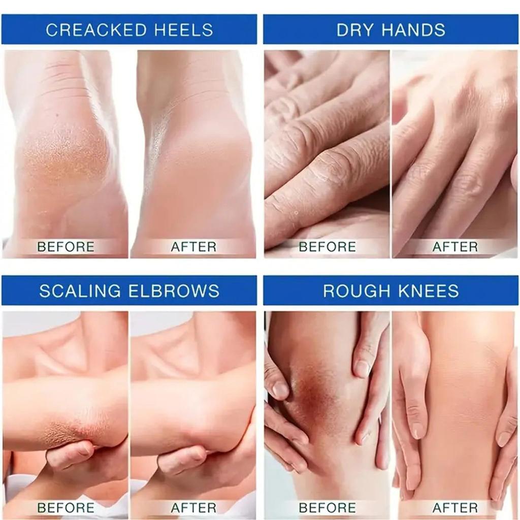 Увлажняющий крем для ног Heel Crack Repair отбеливающий крем для кожи антивозрастной крем для лица