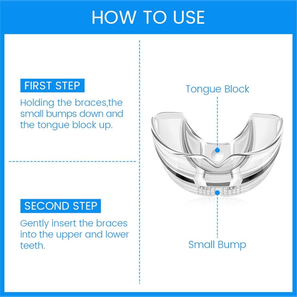 3 этапа стоматологические ортодонтические брекеты фиксатор для зубов при бруксизме каппа выпрямитель для зубов стоп устройство против храпа