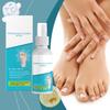 Care Spray Fungus Nail Care Toenail Soft Nail Care Deep Nourish And Enhance Nail Elasticity,50ML
