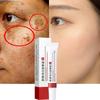 Whitening and Anti-freckle Cream Moisturizing Brightening Soft Silky Refreshing Non-greasy Freckles Removal Facial Cream4.7More Than 1000 Purchases