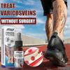 Varicose Vein Massage Spray for - Say Goodbye to Le