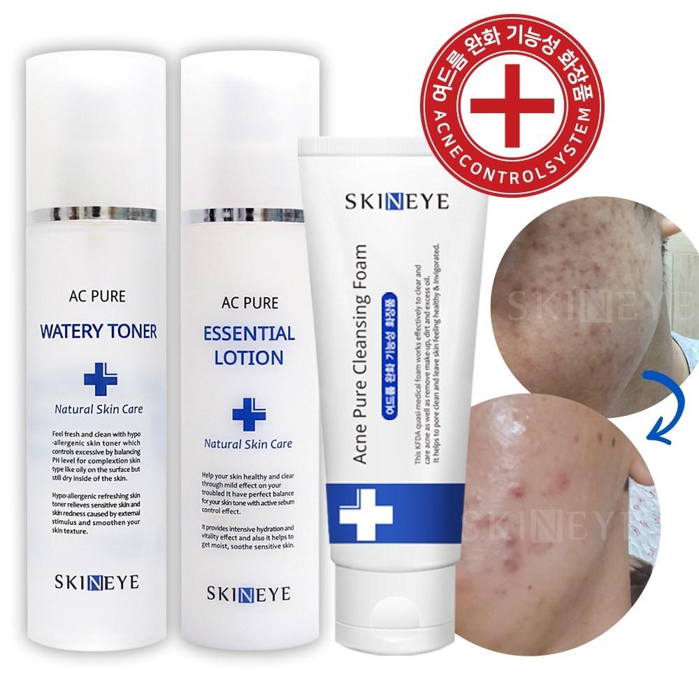 Skineye AC Pure Watery Toner + Essential Lotion Acne Youth Очищающая пенка от прыщей (Базовый набор для ухода за кожей с акне, 3 типа), 1 комплект