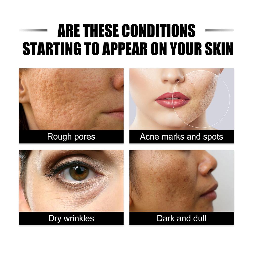 Ginseng Snail Extract Brighten Skin Tone Nourish Repair Dull Skin Fade Fine Lines Anti-Wrinkle Essence