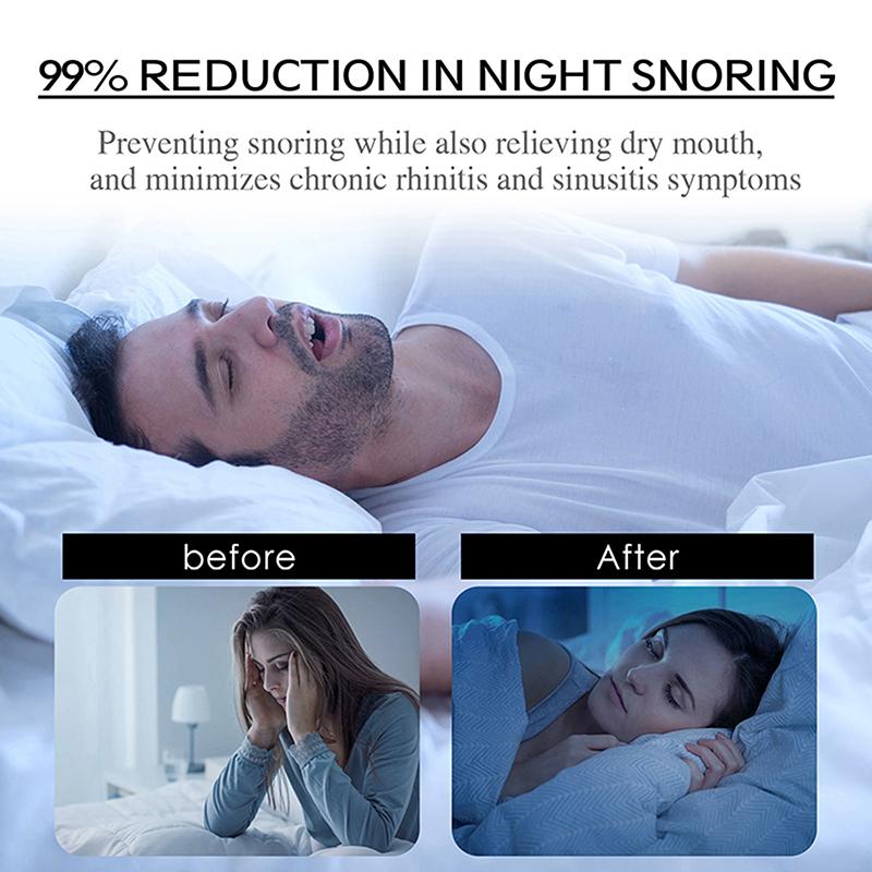 30Pcs Anti Snoring Sleep Mouth Tape Best Breathing Nasal Strips Medical Grade Improved Sleeping Keep Mouth Close Prevent Snoring