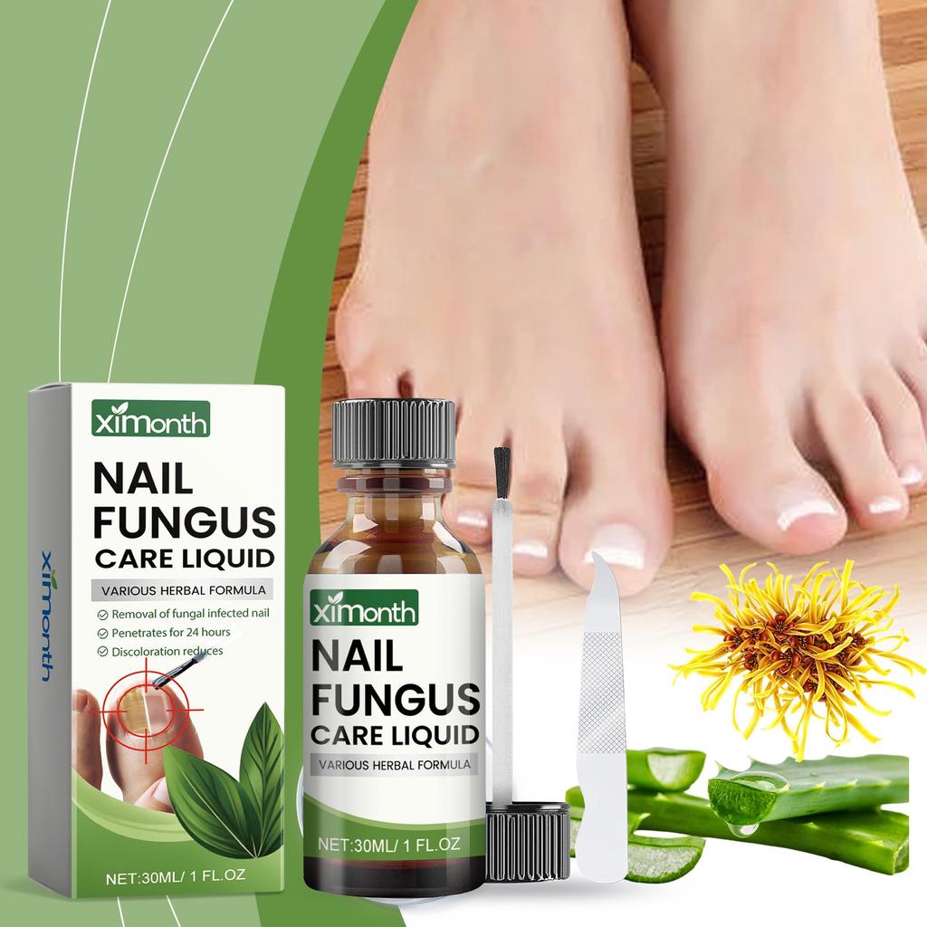 Toenail Fungus TreatmentExtra Strong, NailTreatment, Nail Care TreatmentExtra Strong For Thick, Discolored And Damaged Nails