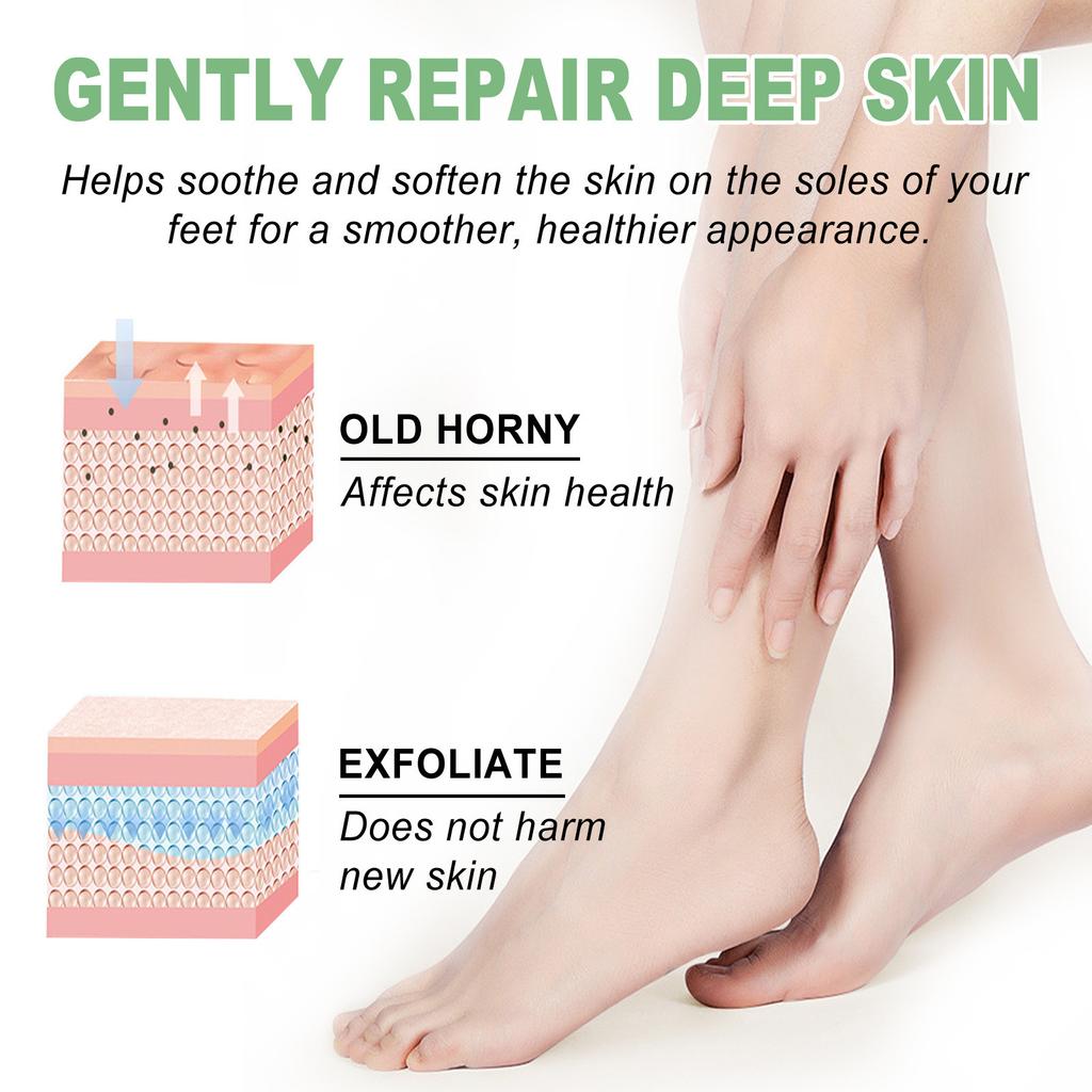 Крем для ног Heel Rescue, для потрескавшейся, мозолистой или потрескавшейся кожи. Отшелушивание пяток для предотвращения сухости, трещин и мозолей на ногах.