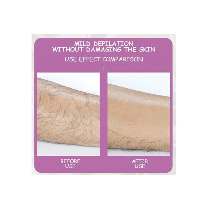 Épilateur - Crystal Hair Eraser - Indolore - Portable - Gomme à cheveux - Pour femme