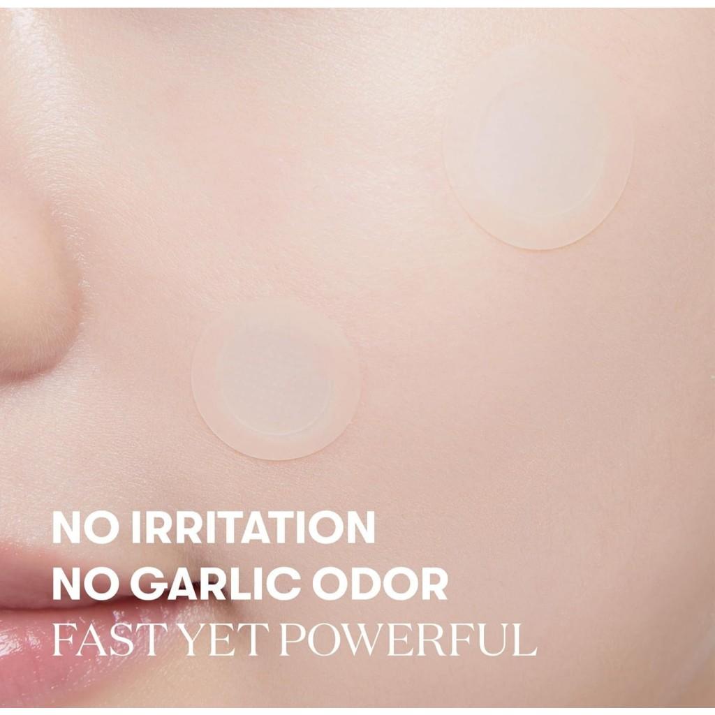 VT COSMETICS Garlic AC Reedle Shot Point Patch, Spot Patch for Early-Stage Blemishes (9 Patches)
