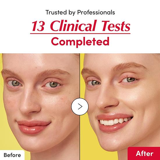 Eqqualberry Витаминная сыворотка для сияния кожи 30 мл