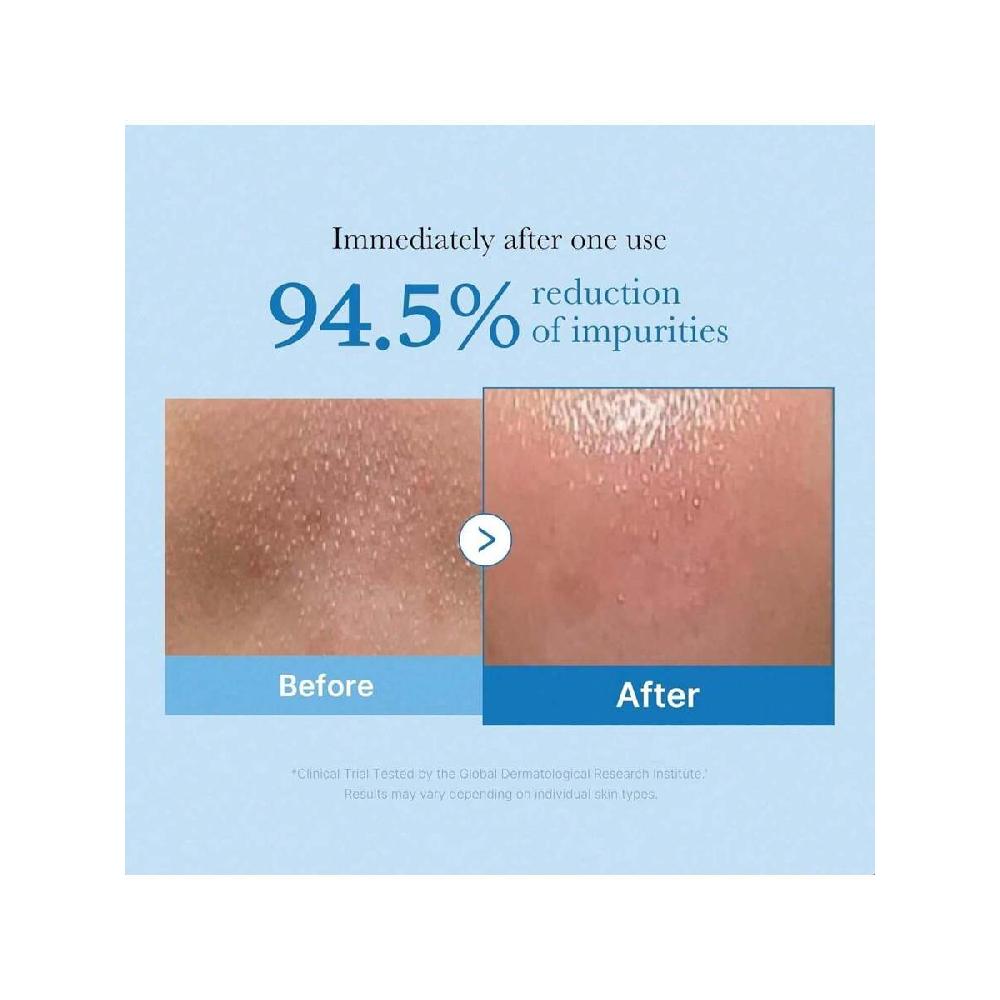 Medicube Zero Pore Blackhead Deep Cleansing Oil 205ml Makeup Remover For All Skin Types, Daily Moisture Facial Cleanser, Low-Irritation