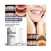 Calculusfree Dissolving Dental Spray, Dental Calculus Remover Teeth Cleaner, Mouth Refreshing Spray