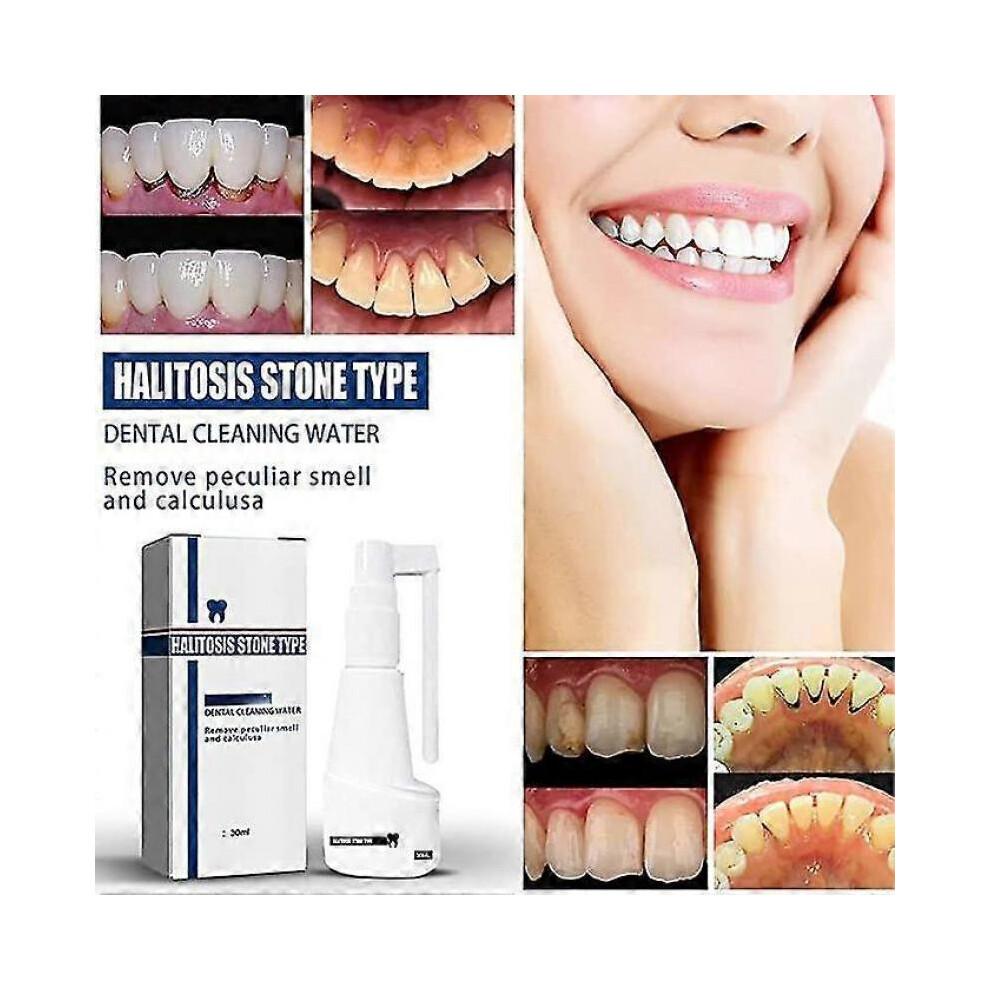 Calculusfree Dissolving Dental Spray, Dental Calculus Remover Teeth Cleaner, Mouth Refreshing Spray