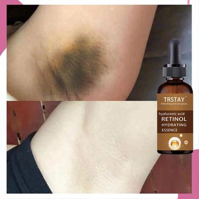 Крем для депиляции для женщин/мужчин, крем для депиляции ног, отбеливающий крем для кожи