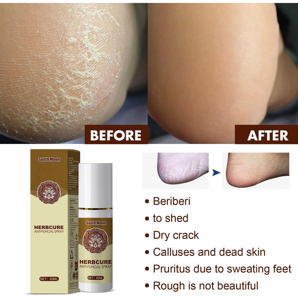 South Moon Herbal Foot Mist Foot Skin Moisturizer Hydration Anti-Cracking Skin Mild Conditioner