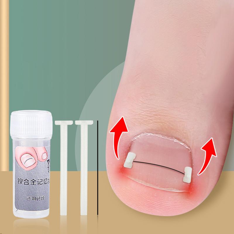 Ingrown Toenail Corrector Tools Pedicure Recover Embed Toe Nail Treatment Professional Ingrown Toenail Correction Foot Care