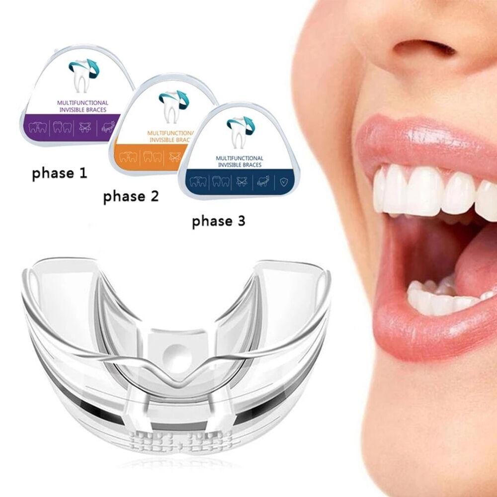 Tool Invisible Bruxism Tooth Retainer Tooth Tray 3 Stage Teeth Corrector