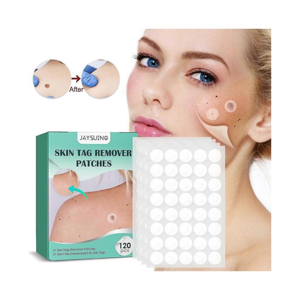 Natural Safe And Effective Ingredients Skin Tag Remover Patches And Improved Formulations Skin Tag Remover Patches