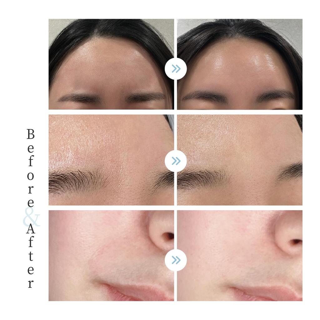 Up To 8 Hours of Wrinkle Relief for Sagging Wrinkles and Smoothing Tape Care for Wrinkles and Nasolabial Lines In the and Lifting Patch Intensive