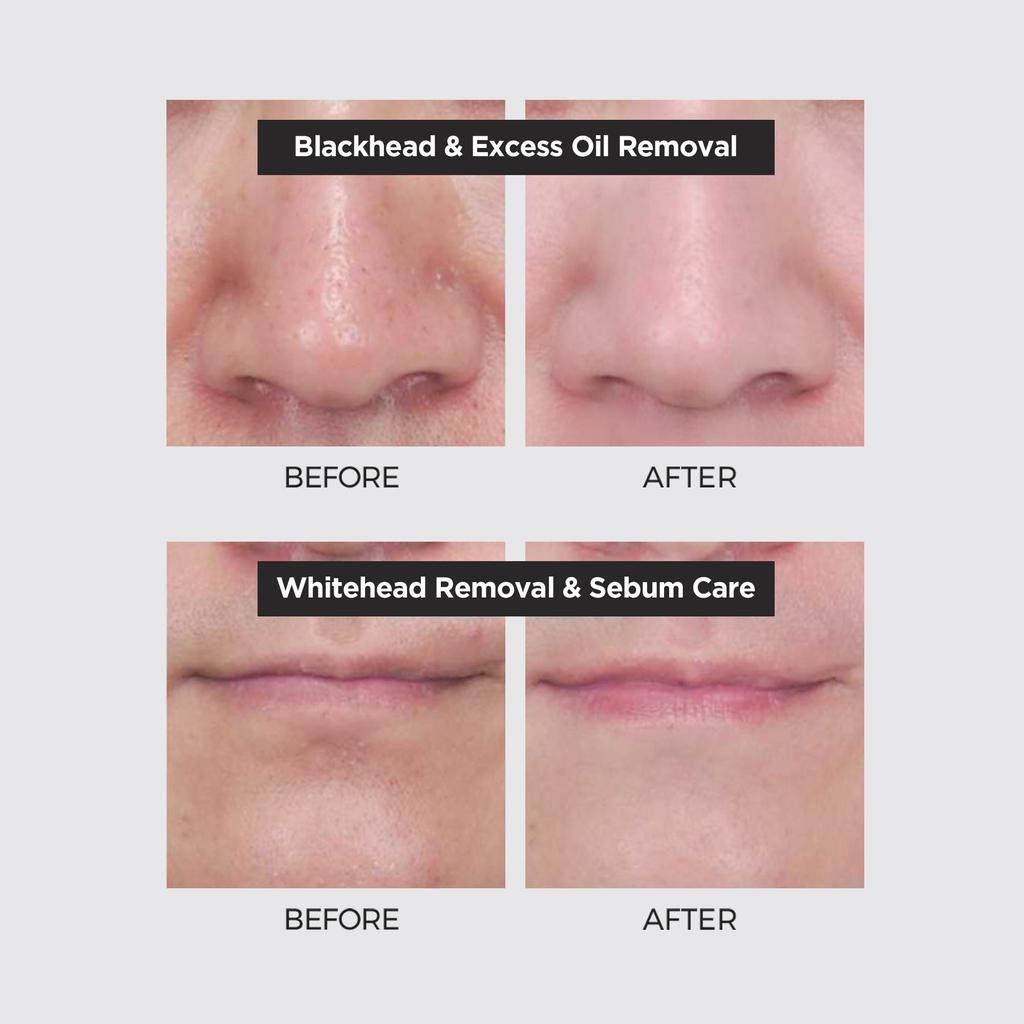 NEOGEN Pore ​​Tight Peeling Mousse 80ml Уход за порами / Уход за омертвевшей кожей