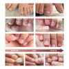 BELYN BERLY Nails Repairing Serum Nourishing Cracked Discolored Nails Essence Nail Treatment Liquid Finger Foot Care 20ml
