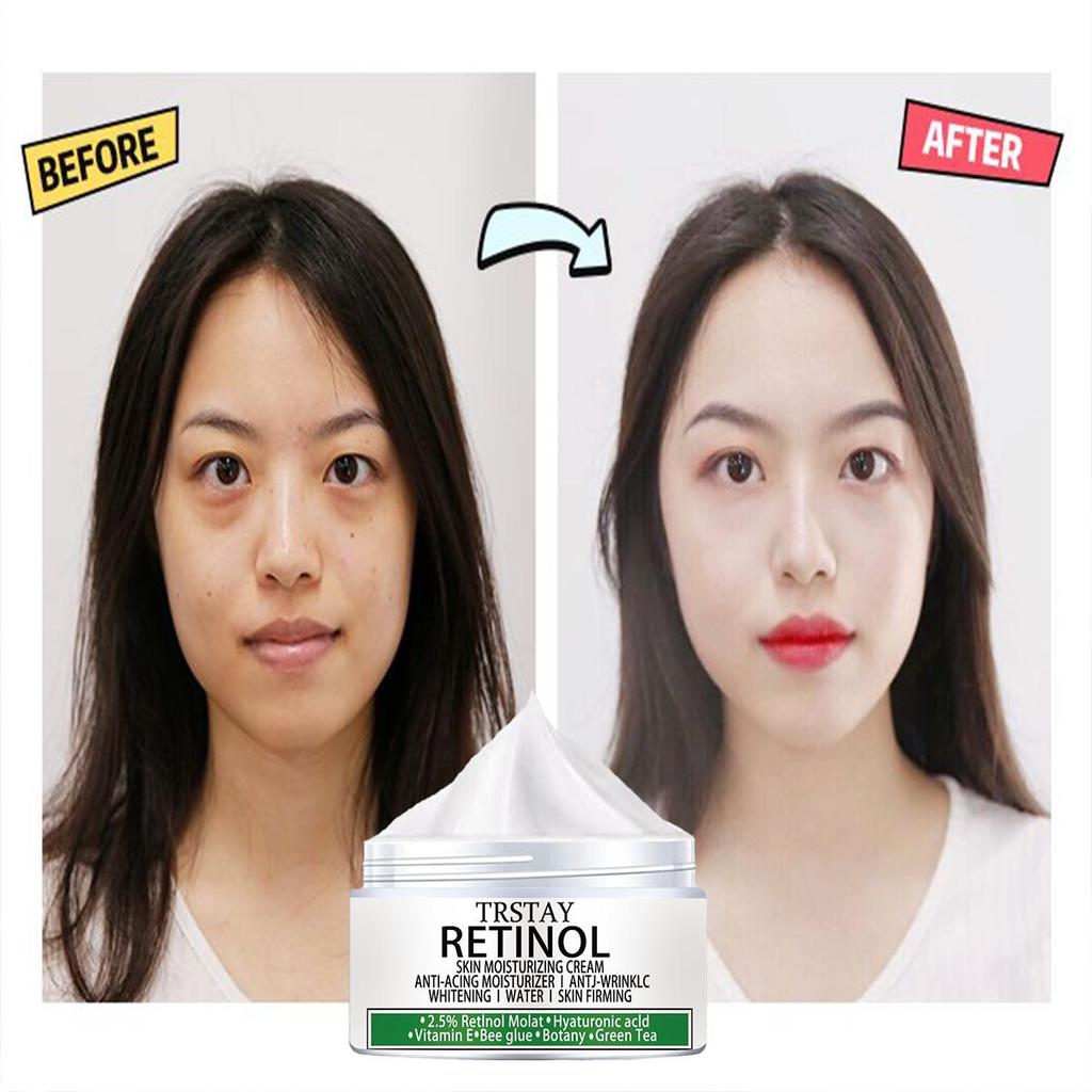 Крем для темной кожи, интимные места, чувствительная зона, подмышки, шея, колени, локти, меланин, осветляющий уход за телом, биоаква-крем