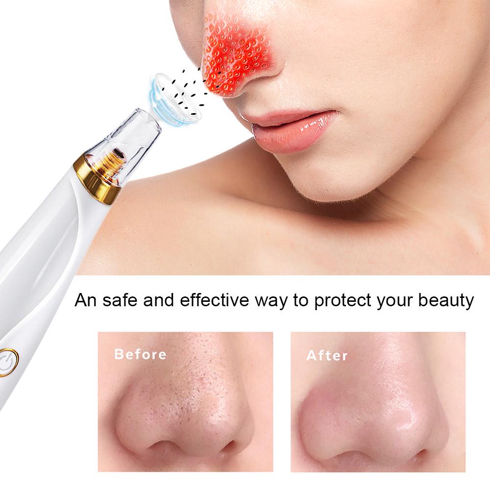 Electric Facial Pore Cleaner Acne Blackhead Removal Extractor Machine USB Rechargeable Skin Cleaner Beauty Tool Kit